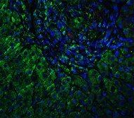 抗 VPS39 兔抗 affinity isolated antibody