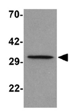 Anti-ApoA5 Antibody from rabbit, purified by affinity chromatography