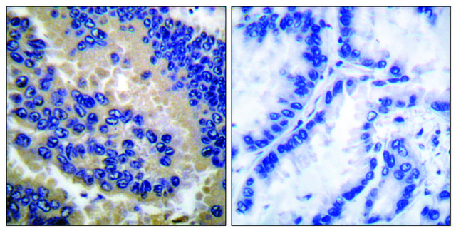 Anti-CSPN3 (Cleaved-Asp175) antibody produced in rabbit affinity isolated antibody