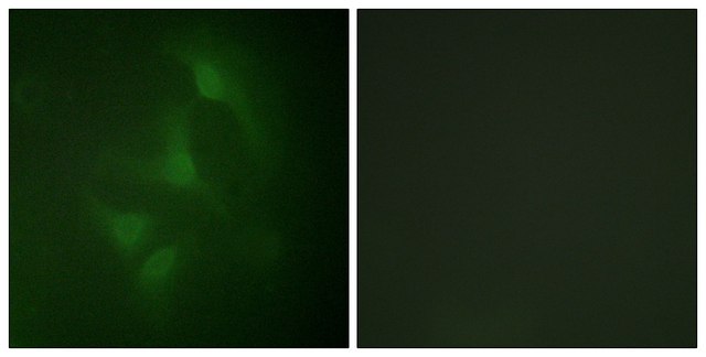 Anti-JNK1 antibody produced in rabbit affinity isolated antibody