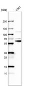 Anti-TROVE2 antibody produced in rabbit Prestige Antibodies® Powered by Atlas Antibodies, affinity isolated antibody, buffered aqueous glycerol solution