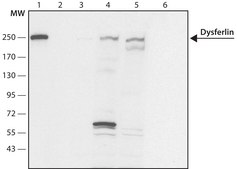 Anti-Dysferlin antibody produced in rabbit ~1.0 mg/mL, affinity isolated antibody