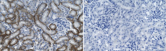 Anti-SCA-1/LY6A-E Antibody, clone 1J4-H2 ZooMAb&#174; Rabbit Monoclonal recombinant, expressed in HEK 293 cells