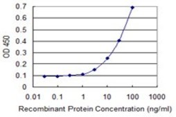 Monoclonal Anti-ABLIM1 antibody produced in mouse clone 2C6, purified immunoglobulin, buffered aqueous solution