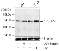 Anti-Phospho-p53-S9 antibody produced in rabbit