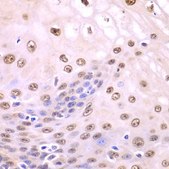 Anti-SQSTM1/p62 antibody produced in rabbit