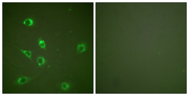 抗-胰高血糖素 兔抗 affinity isolated antibody