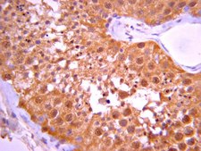 Anti-Protein Phosphatase 2 C α/β Antibody from rabbit