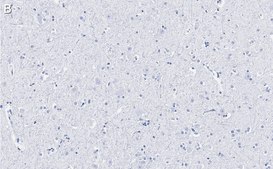 Anti-BSN Antibody, clone 2I2 ZooMAb® Rabbit Monoclonal recombinant, expressed in HEK 293 cells