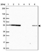 Anti-EIF3D antibody produced in rabbit Prestige Antibodies® Powered by Atlas Antibodies, affinity isolated antibody, buffered aqueous glycerol solution