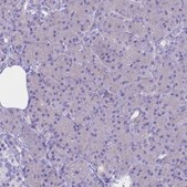 Anti-CLEC2L antibody produced in rabbit Prestige Antibodies® Powered by Atlas Antibodies, affinity isolated antibody, buffered aqueous glycerol solution