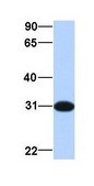 Anti-MBNL2 antibody produced in rabbit affinity isolated antibody