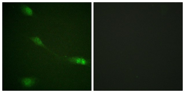 Anti-MDM2 antibody produced in rabbit affinity isolated antibody