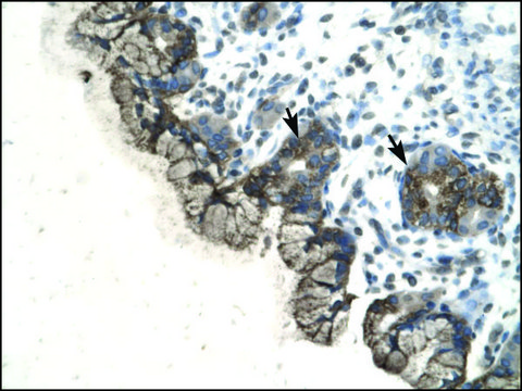 Anti-PARP3 antibody produced in rabbit affinity isolated antibody