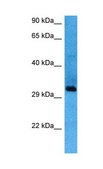 Anti-SIX1 affinity isolated antibody