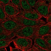 Anti-EVPLL antibody produced in rabbit Prestige Antibodies® Powered by Atlas Antibodies, affinity isolated antibody, buffered aqueous glycerol solution