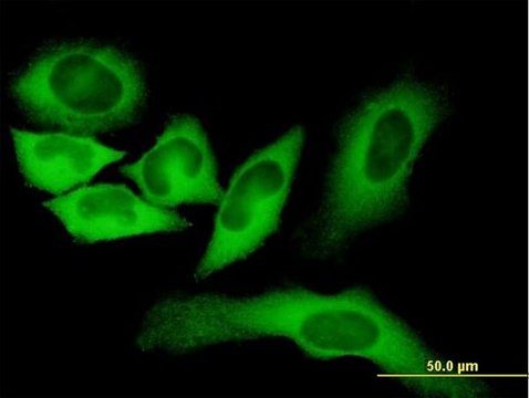 Monoclonal Anti-FASN antibody produced in mouse clone 3B3-1D6, purified immunoglobulin, buffered aqueous solution