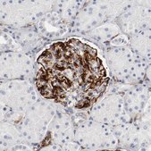 Anti-GIT1 antibody produced in rabbit Ab2, Prestige Antibodies® Powered by Atlas Antibodies, affinity isolated antibody, buffered aqueous glycerol solution