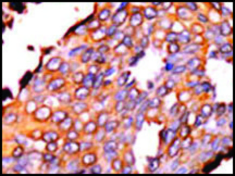 Anti-RFK (N-term) antibody produced in rabbit IgG fraction of antiserum, buffered aqueous solution