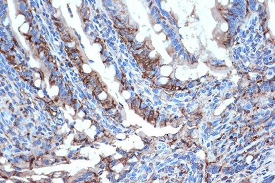 Anti-FABPI antibody produced in rabbit