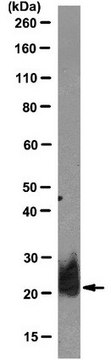 Anti-Thy-1 Antibody, clone M5/49 clone M549.4.1, from rat