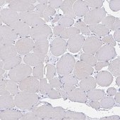 Anti-PACSIN1 antibody produced in rabbit Prestige Antibodies® Powered by Atlas Antibodies, affinity isolated antibody, buffered aqueous glycerol solution