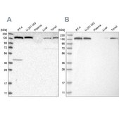 Anti-PFAS antibody produced in rabbit Prestige Antibodies® Powered by Atlas Antibodies, affinity isolated antibody, buffered aqueous glycerol solution, Ab2