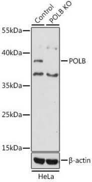 Anti-POLB antibody produced in rabbit