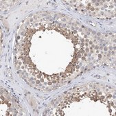 Anti-KIAA1109 antibody produced in rabbit Prestige Antibodies® Powered by Atlas Antibodies, affinity isolated antibody, buffered aqueous glycerol solution
