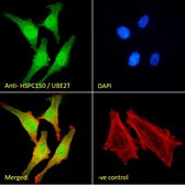 Anti-HSPC150/UBE2T antibody produced in goat affinity isolated antibody, buffered aqueous solution