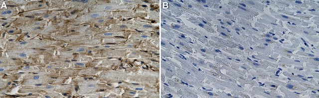 Anti-AHNAK Antibody, clone 1H6 ZooMAb&#174; Rabbit Monoclonal recombinant, expressed in HEK 293 cells