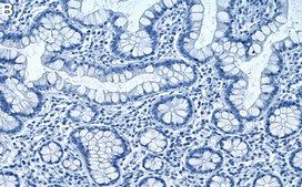 Anti-PPARα Antibody, clone 4G22 ZooMAb® Rabbit Monoclonal recombinant, expressed in HEK 293 cells