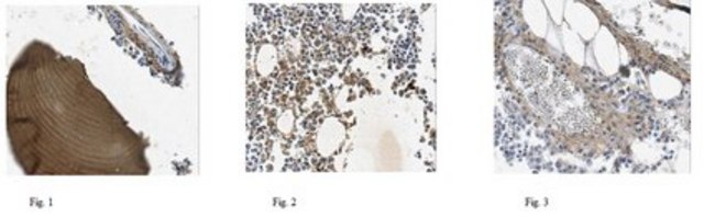 Anti-COL1A2, clone alpha2CT, Azide Free Antibody clone alpha2CT, from mouse