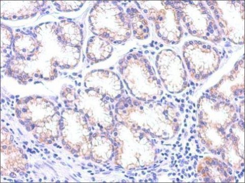 Monoclonal Anti-TSG101 antibody produced in mouse