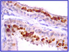 抗JAK2抗体，克隆8E10.2 clone 8E10.2, Upstate®, from mouse