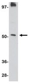 Anti-MATN3 Antibody from rabbit, purified by affinity chromatography