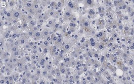 Anti-ABCA1 Antibody, clone 1J11 ZooMAb&#174; Rabbit Monoclonal recombinant, expressed in HEK 293 cells