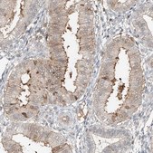 Anti-CEP162 antibody produced in rabbit Prestige Antibodies® Powered by Atlas Antibodies, affinity isolated antibody, buffered aqueous glycerol solution, ab1