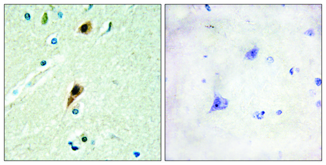 Anti-RBM5 antibody produced in rabbit affinity isolated antibody