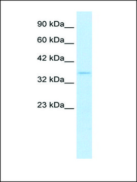 Anti-SHOX2 antibody produced in rabbit affinity isolated antibody