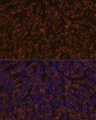 Anti-ANGPTL3 antibody produced in rabbit