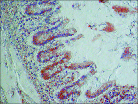 Anti-NOX1 antibody produced in rabbit ~1.5&#160;mg/mL, affinity isolated antibody