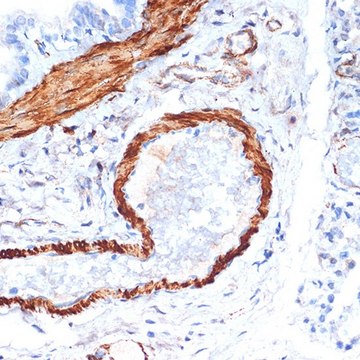 Anti-&#945;-Actin-1 (ATCA1) antibody produced in rabbit