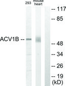 Anti-ACV1B antibody produced in rabbit affinity isolated antibody