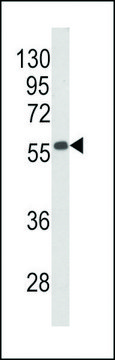 ANTI-BECLIN1-BH3 DOMAIN antibody produced in rabbit affinity isolated antibody, buffered aqueous solution