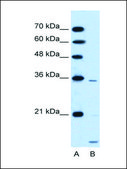 Anti-SLC25A39 antibody produced in rabbit affinity isolated antibody