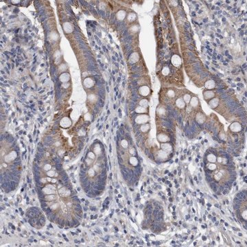 Anti-DDHD2 antibody produced in rabbit Prestige Antibodies&#174; Powered by Atlas Antibodies, affinity isolated antibody, buffered aqueous glycerol solution, Ab1