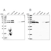 Anti-TOR1AIP1 antibody produced in rabbit Prestige Antibodies® Powered by Atlas Antibodies, affinity isolated antibody, buffered aqueous glycerol solution