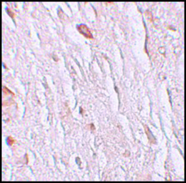 Anti-ZIP7 antibody produced in rabbit affinity isolated antibody