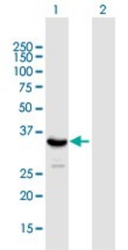 抗 SIRT4 小鼠抗 purified immunoglobulin, buffered aqueous solution